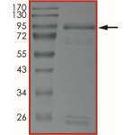 EGFR (T790M C797S L858R R999A), Active